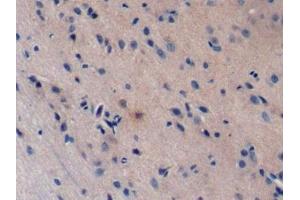 Detection of Bid in Rat Cerebrum Tissue using Polyclonal Antibody to BH3 Interacting Domain Death Agonist (Bid) (BID anticorps  (AA 1-196))