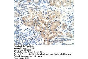 Rabbit Anti-DLAT Antibody  Paraffin Embedded Tissue: Human Kidney Cellular Data: Epithelial cells of renal tubule Antibody Concentration: 4. (DLAT anticorps  (N-Term))