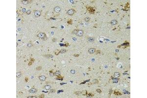 Immunohistochemistry of paraffin-embedded Rat brain using PTPN3 Polyclonal Antibody at dilution of 1:100 (40x lens). (PTPN3 anticorps)