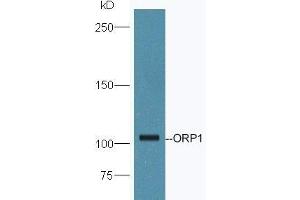 Mouse brain lysates probed with Anti-ORP1 Polyclonal Antibody, Unconjugated (ABIN2178099) at 1:300 in 4˚C. (OSBPL1A anticorps  (AA 851-950))