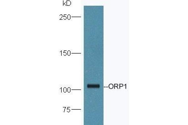 OSBPL1A anticorps  (AA 851-950)