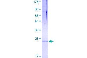 SDS-PAGE (SDS) image for Tumor Necrosis Factor (Ligand) Superfamily, Member 10 (TNFSF10) (AA 114-281) protein (His-DYKDDDDK-Strep II Tag) (ABIN4369885)