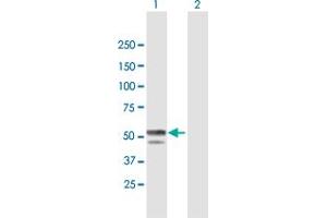 Western Blot analysis of BLMH expression in transfected 293T cell line by BLMH MaxPab polyclonal antibody. (BLMH anticorps  (AA 1-455))