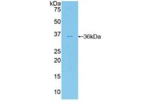 Western blot analysis of recombinant Human FDFT1. (FDFT1 anticorps  (AA 269-417))