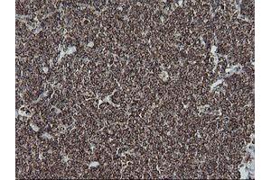 Image no. 2 for anti-NADH Dehydrogenase (Ubiquinone) 1 beta Subcomplex, 10, 22kDa (NDUFB10) antibody (ABIN1499669)