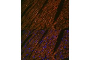 Immunofluorescence analysis of rat heart using Desmin Rabbit mAb (ABIN1678733, ABIN3018020, ABIN3018021 and ABIN7101569) at dilution of 1:100 (40x lens). (Desmin anticorps)