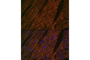 Immunofluorescence analysis of rat heart using Desmin Rabbit mAb (ABIN1678733, ABIN3018020, ABIN3018021 and ABIN7101569) at dilution of 1:100 (40x lens).