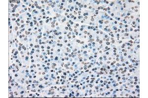 Image no. 16 for anti-Polo-Like Kinase 1 (PLK1) antibody (ABIN1500282)