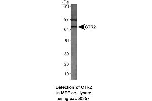 Image no. 1 for anti-Solute Carrier Family 31 (Copper Transporters), Member 2 (SLC31A2) (AA 50-100) antibody (ABIN363666)