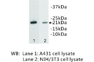 Image no. 1 for anti-Caveolin 1, Caveolae Protein, 22kDa (CAV1) antibody (ABIN1112799)