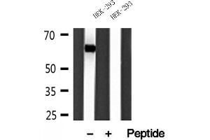 Western blot analysis of extracts of HEK-293 cells, using Sestrin 2 antibody.