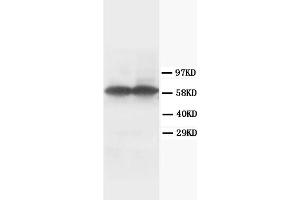 Western Blotting (WB) image for anti-Tyrosine Hydroxylase (TH) antibody (ABIN1109422) (Tyrosine Hydroxylase anticorps)