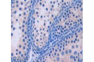 Used in DAB staining on fromalin fixed paraffin- embedded Kidney tissue