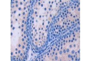 Used in DAB staining on fromalin fixed paraffin- embedded Kidney tissue (GGPS1 anticorps  (AA 78-258))