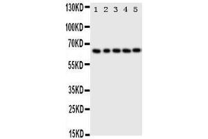 Anti-p63 antibody, Western blotting Lane 1: HELA Cell Lysate Lane 2: SMMC Cell Lysate Lane 3: COLO320 Cell Lysate Lane 4: A549 Cell Lysate Lane 5: SGC Cell Lysate