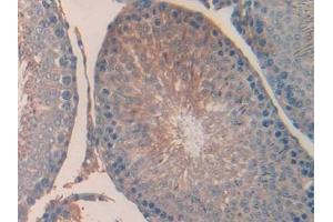 Detection of UCN in Rat Testis Tissue using Polyclonal Antibody to Urocortin (UCN)