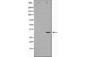 Western blot analysis of extracts of 293 lysate, using MC2R antibody.
