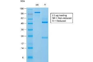 SDS-PAGE Analysis Purified Filaggrin Rabbit Recombinant Monoclonal Antibody (FLG/1957R). (Recombinant Filaggrin anticorps  (AA 198-288))