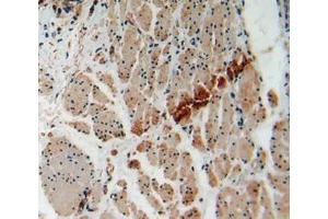 Used in DAB staining on fromalin fixed paraffin- embedded esophagus cancer tissue (FOXO1 anticorps  (AA 333-557))