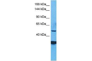 WB Suggested Anti-ZSC29 antibody Titration: 1 ug/mL Sample Type: Human RPMI-8226 Whole Cell (ZSCAN29 anticorps  (Middle Region))