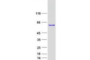 Validation with Western Blot