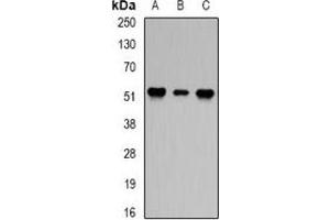 Western blot analysis of PPP2R2A expression in Hela (A), Jurkat (B), mouse brain (C) whole cell lysates.