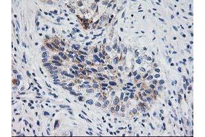 Image no. 2 for anti-X-Prolyl Aminopeptidase (Aminopeptidase P) 3, Putative (XPNPEP3) antibody (ABIN1501766)
