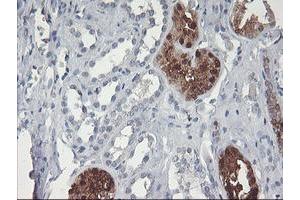 Immunohistochemistry (IHC) image for anti-Glucosidase, Beta, Acid 3 (Cytosolic) (GBA3) (AA 1-150), (AA 370-469) antibody (ABIN1490581)