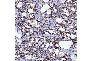 IHC analysis of SH2D4A using anti-SH2D4A antibody (ABIN7601695). (SH2D4A anticorps  (AA 42-454))