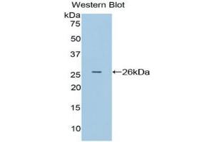 Detection of Recombinant APC, Rat using Polyclonal Antibody to Adenomatosis Polyposis Coli Protein (APC)