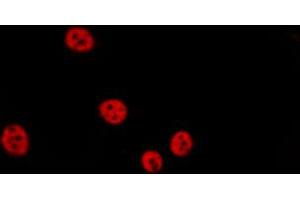 ABIN6267063 staining Hela by IF/ICC. (Histone H4 anticorps  (acLys12))