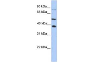 Western Blotting (WB) image for anti-Methyltransferase Like 2B (METTL2B) antibody (ABIN2463220) (METTL2B anticorps)