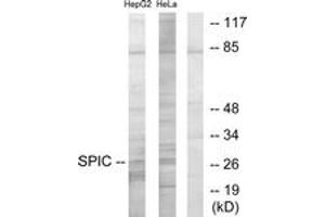 Western blot analysis of extracts from HepG2/HeLa cells, using SPIC Antibody. (SPIC anticorps  (AA 131-180))