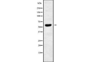 Western blot analysis of TIGD2 using K562 whole cell lysates (TIGD2 anticorps)