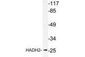 Western blot analysis of HADH2 antibody in extracts from LOVO cells. (HSD17B10 anticorps)