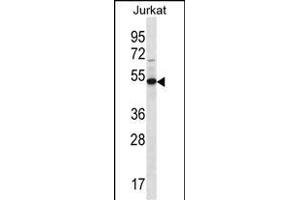 FA8A1 Antibody (N-term) (ABIN656718 and ABIN2845946) western blot analysis in Jurkat cell line lysates (35 μg/lane).