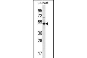 FA8A1 Antibody (N-term) (ABIN656718 and ABIN2845946) western blot analysis in Jurkat cell line lysates (35 μg/lane). (FAM8A1 anticorps  (N-Term))