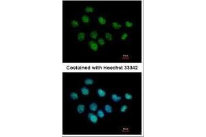 ICC/IF Image Immunofluorescence analysis of paraformaldehyde-fixed A431, using XPC, antibody at 1:500 dilution.