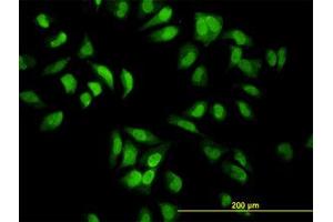 Image no. 1 for anti-Eukaryotic Translation Initiation Factor 2-alpha Kinase 2 (EIF2AK2) (AA 1-101) antibody (ABIN598900) (EIF2AK2 anticorps  (AA 1-101))
