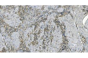 IHC analysis of EEF2/Elongation factor 2 using anti-EEF2/Elongation factor 2 antibody (ABIN7603142). (EEF2 anticorps  (N-Term))