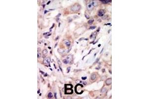 anti-Receptor Tyrosine Kinase-Like Orphan Receptor 2 (ROR2) (AA 915-943), (C-Term) antibody