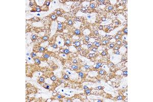 Immunohistochemistry of paraffin-embedded Human liver using MITD1 Rabbit pAb (ABIN7268548) at dilution of 1:100 (40x lens).