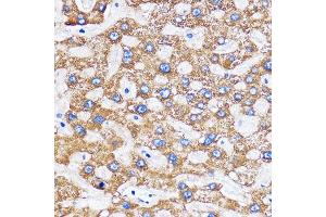 Immunohistochemistry of paraffin-embedded Human liver using MITD1 Rabbit pAb (ABIN7268548) at dilution of 1:100 (40x lens). (MITD1 anticorps)