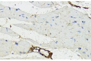 Immunohistochemistry of paraffin-embedded Mouse heart using Complement Factor B Polyclonal Antibody at dilution of 1:200 (40x lens). (Complement Factor B anticorps)