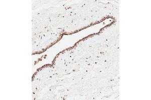 Immunohistochemical analysis of paraffin-embedded Human breast tissue using (ABIN654330 and ABIN2844106) performed on the Leica® BOND RXm.