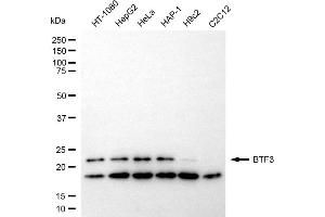 Western blotting analysis using BTF3 antibody (ABIN7797733).