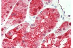 Rabbit Anti-KHK antibody  Formalin Fixed Paraffin Embedded Tissue: Human Kidney Primary antibody Concentration: 1:100 Secondary Antibody: Donkey anti-Rabbit-Cy3 Secondary Antibody Concentration: 1:200 Magnification: 20x Exposure Time: 0.