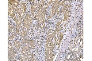 IHC analysis of SND1 using anti-SND1 antibody (ABIN7600525). (SND1 anticorps  (AA 20-204))