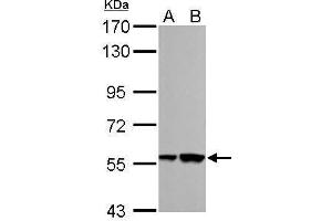 WB Image RBMY1A1 antibody detects RBMY1A1 protein by Western blot analysis. (RBMY1A1 anticorps)