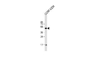 Anti-MYCN Antibody (C-term) at 1:1000 dilution + CCRF-CEM whole cell lysate Lysates/proteins at 20 μg per lane.
